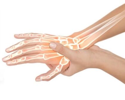 Hondrox tepamas ant pažeistos vietos