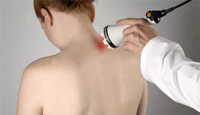 fizioterapija gimdos kaklelio osteochondrozei gydyti