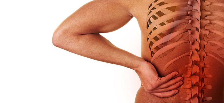 juosmens osteochondrozės simptomai